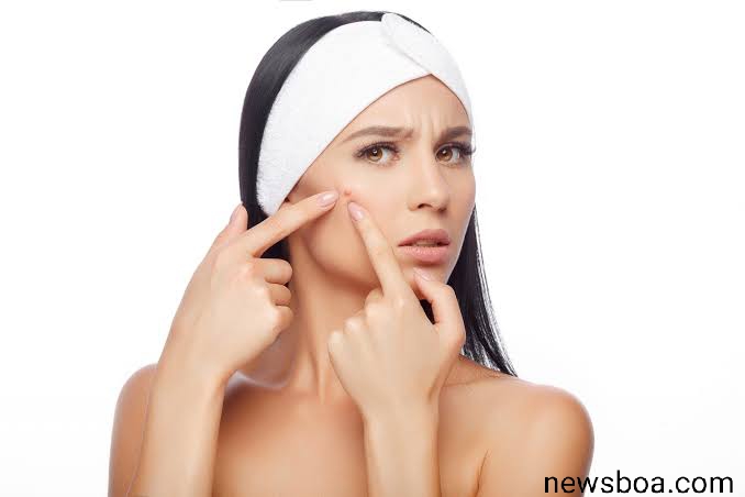 Home Remedies For Acne And Senstive Skin